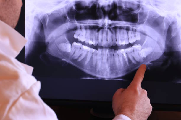 Best Holiday Emergency Dentist in Brooktrails, CA