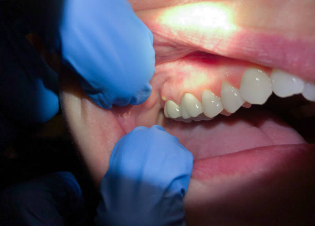 Best Emergency Dental Services for Seniors in Brooktrails, CA